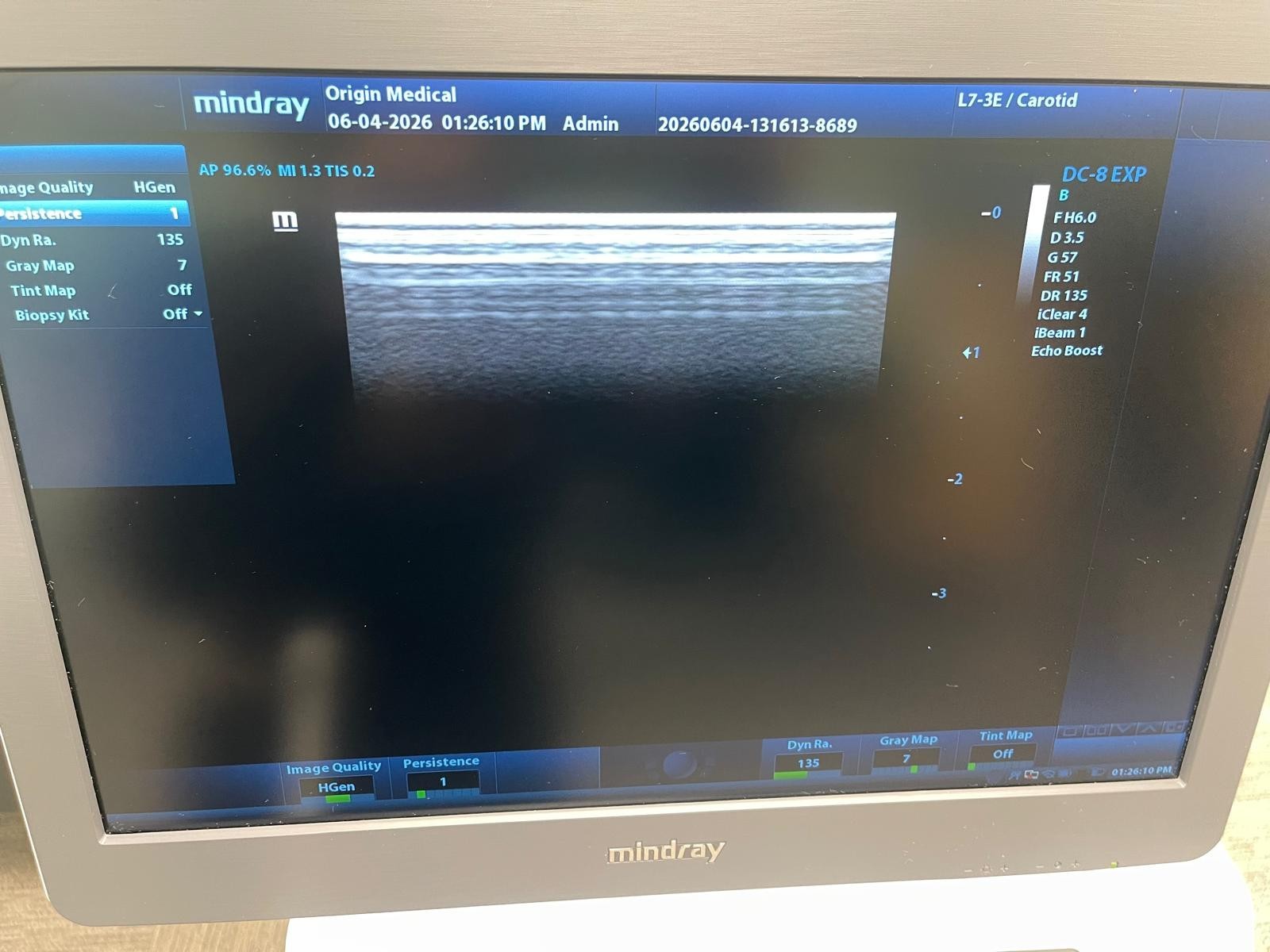 Mindray DC-8 EXP Ultrasound System w/ 2 Transducers