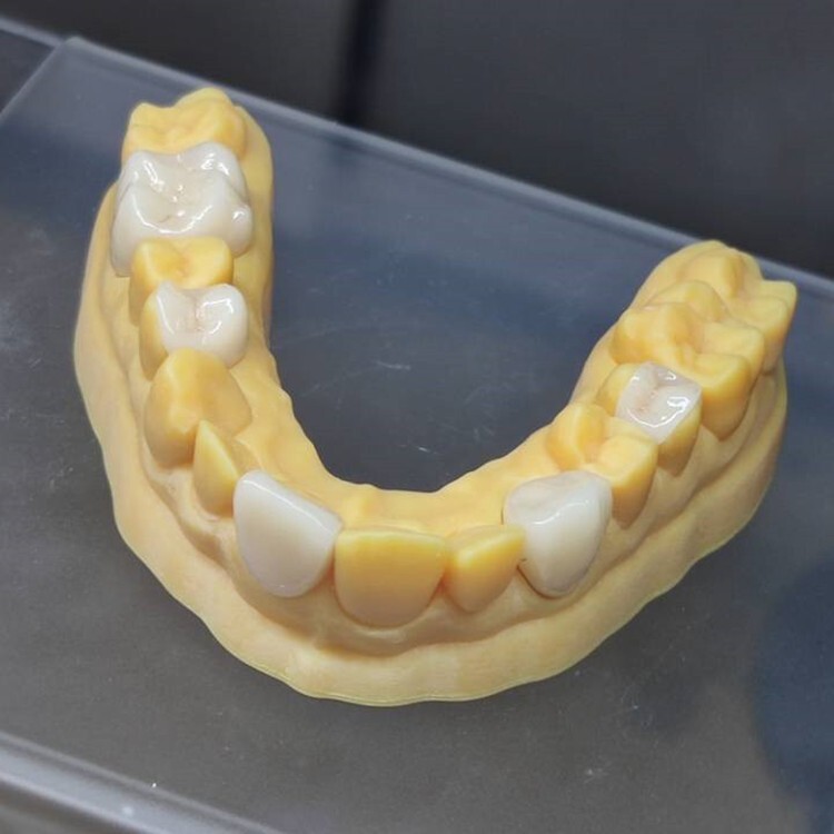 C14 Glass Ceramic Blocks HT LT Lithium Disilicate CAD/CAM Cerec Block 5Pcs/Box