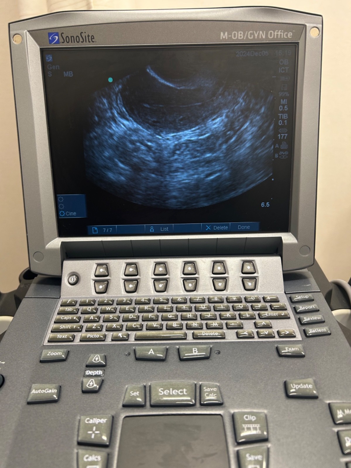 FUJIFILM SonoSite M-Turbo M-OB/GYN Ultrasound C60xi ICTx *Free Shipping