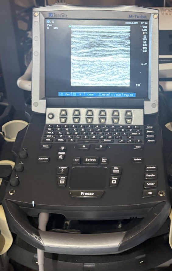 SonoSite M-Turbo Ultrasound System (2014) With 2 Transducer Probe & Rolling Car