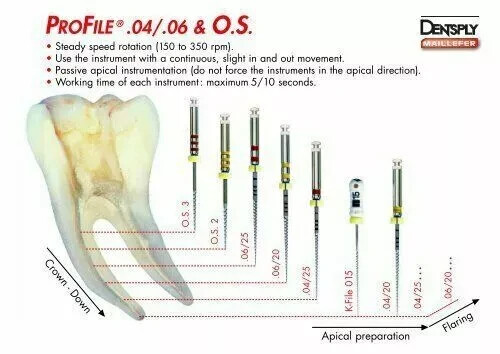 Dentsply Maillefer Dental Profile ISO 21mm rotary files all Taper-6/pk all sizes