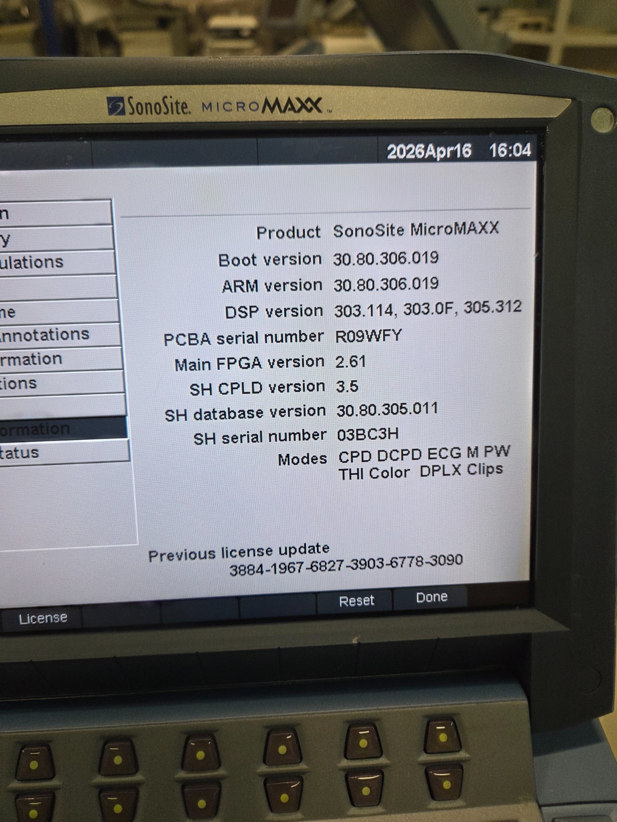 Sonosite Micromaxx Diagnostic Ultrasound System