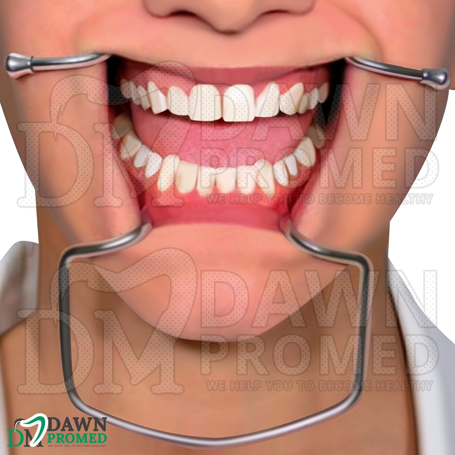 3 Pcs Orringer Cheek Retractor Small, Medium & Large Mouth Opening Oral Set