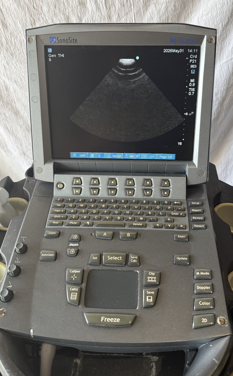 SonoSite M-Turbo Ultrasound System (2014) With 2 Transducer Probe & Rolling Car
