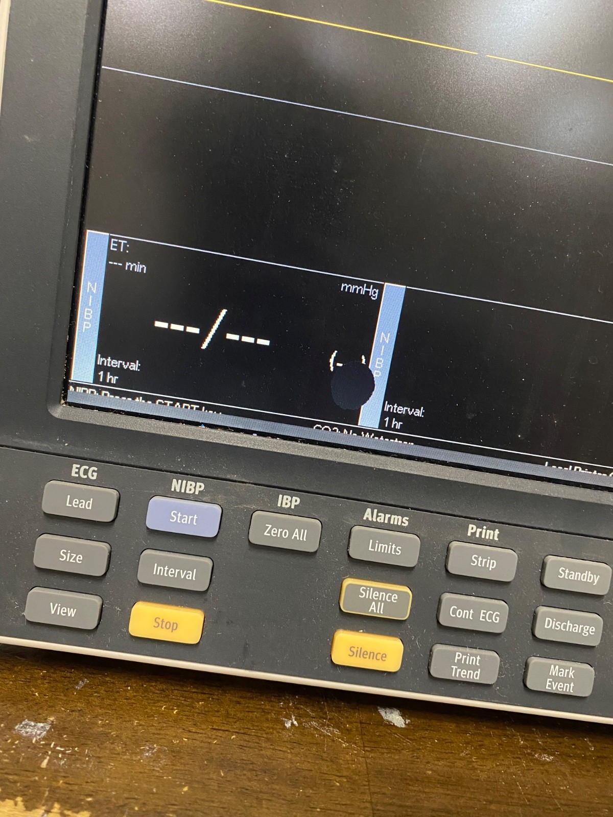 MINDRAY Datascope Passport V Patient Monitor Screen Damage Powers on