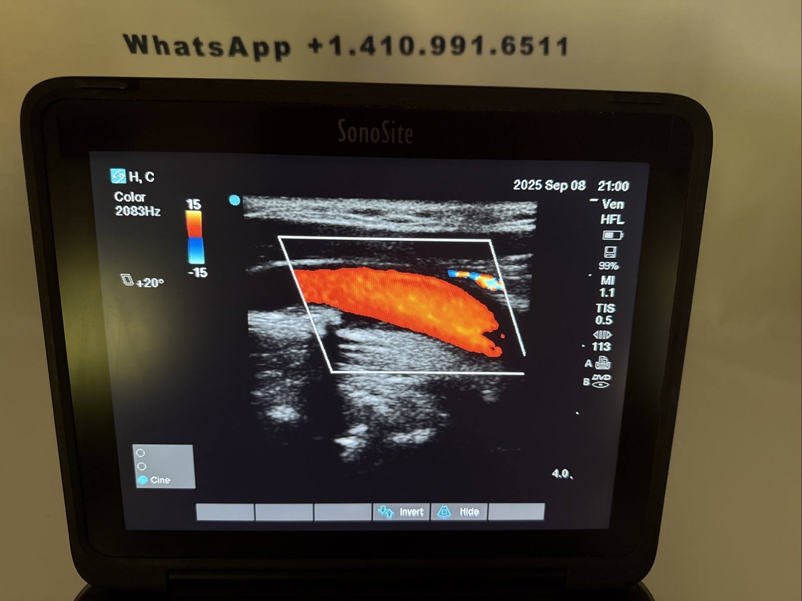 SONOSITE EDGE II 2018 Phased & Linear Transducers. 60 Day Money Back Guarantee