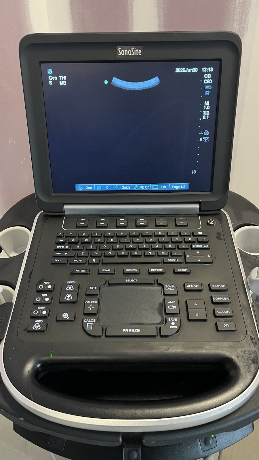SONOSITE EDGE 2015-06 WITH TWO TRANSDUCERS AND ORIGINAL CART