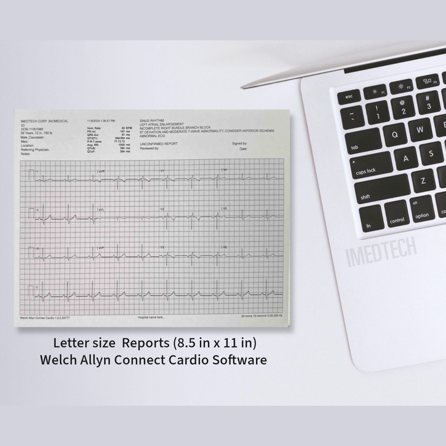 Welch Allyn Diagnostic Cardiology Suite PC ECG with Laptop/ Cadio Connex ECG