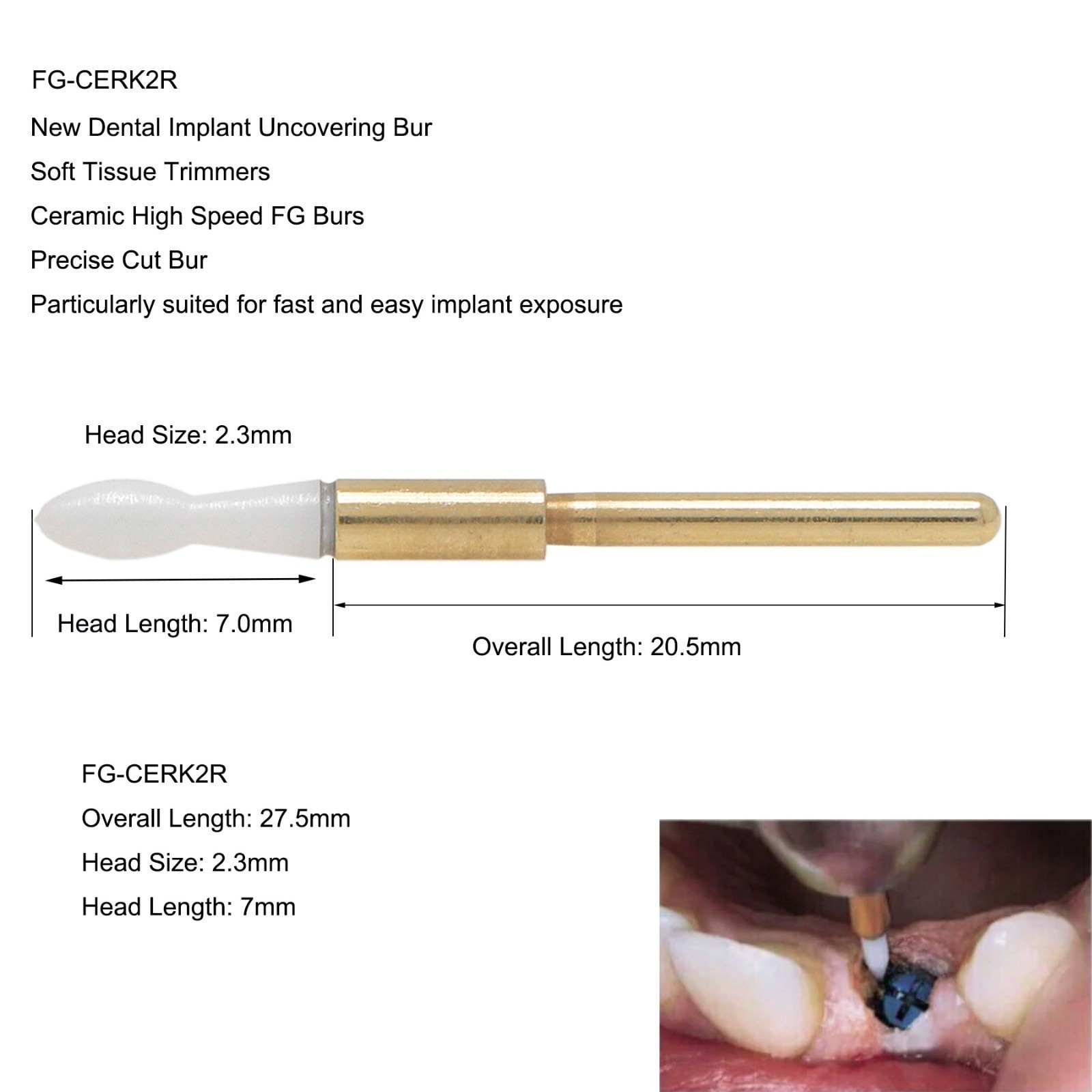 Dental Surgical Ceramic Soft Tissue Trimmer Bur for Gingivectomy 4PCS