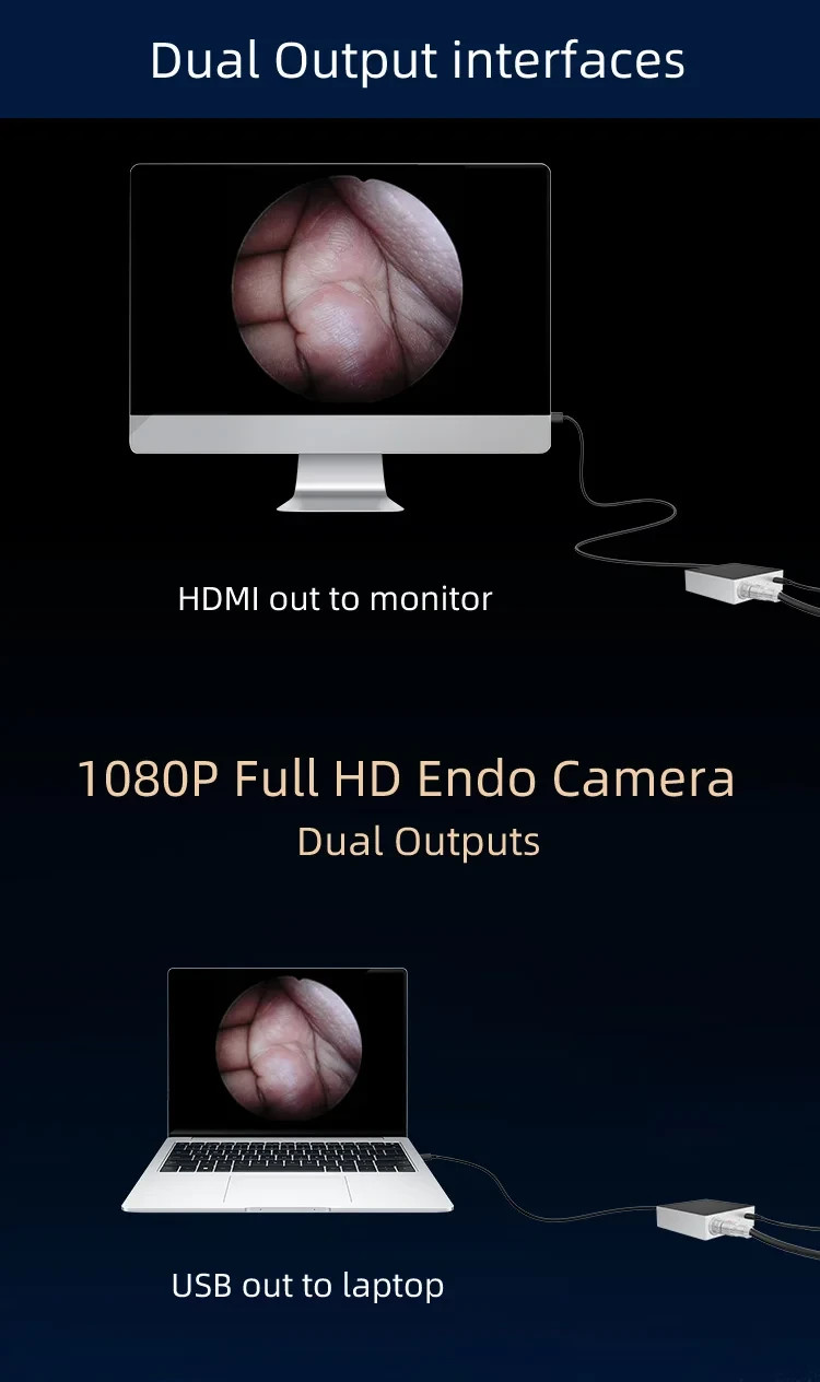 Portable Endoscopy ENT Camera surgery FHD Surgical Camera Endoscope Arthroscopy