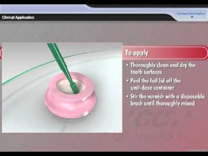 Dental Prevest Hiflex Green Sticks Green Stick Compound 10 sticks (Fast Ship)