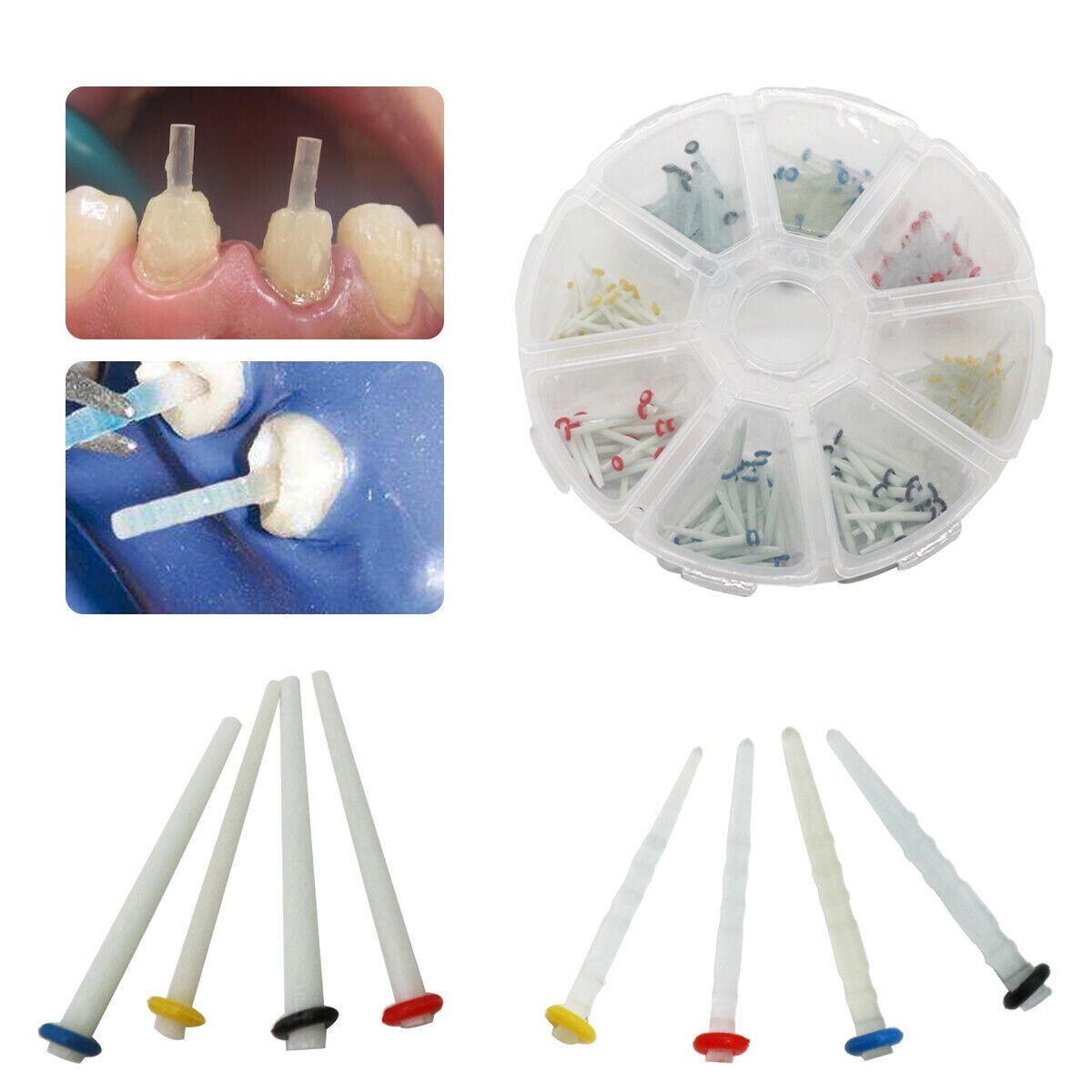 200 Pcs Dental Fiber Post Glass Quartz Teeth Restorative Posts 1.0 1.2 1.4 1.6mm
