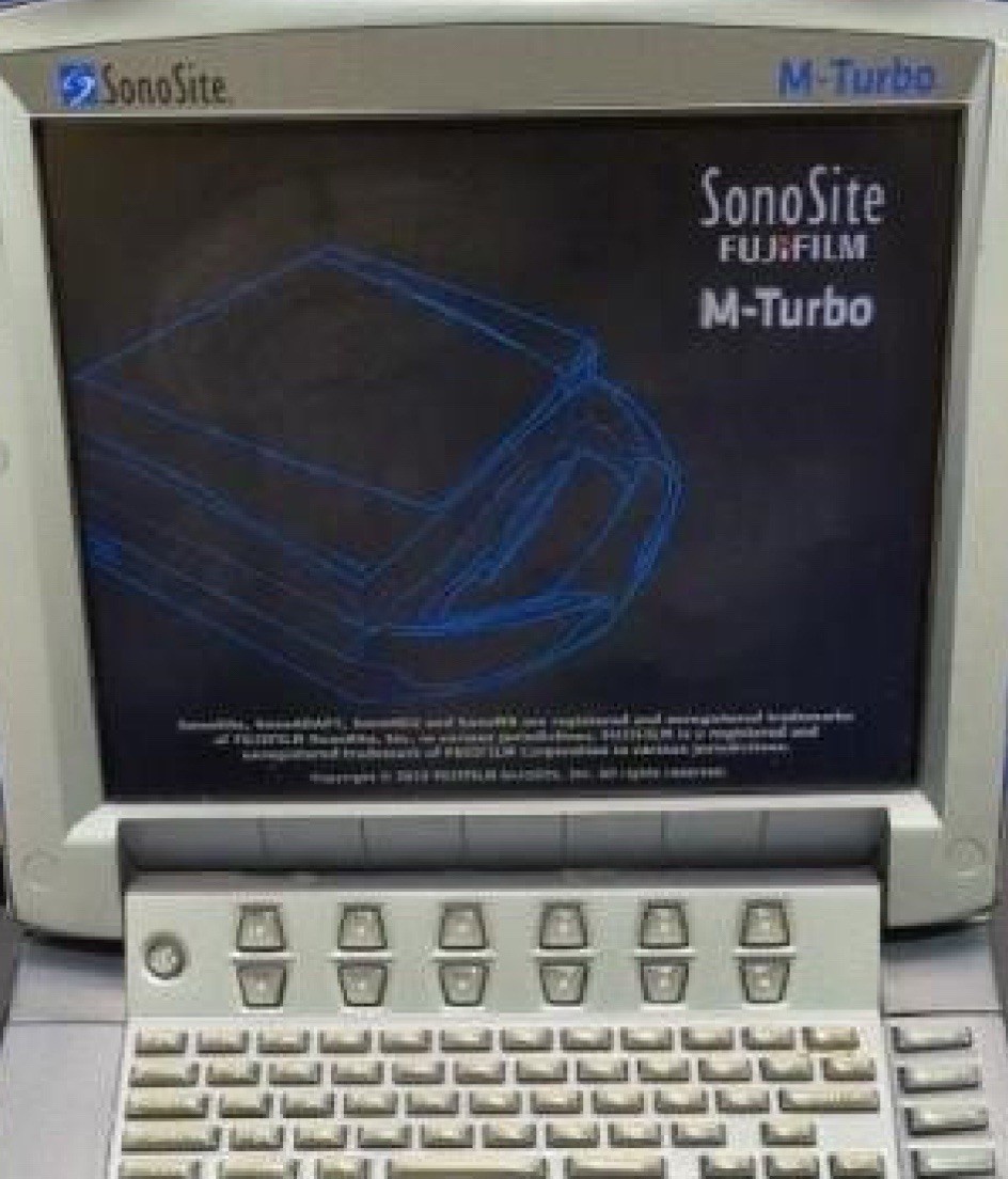 Sonosite M-turbo ultrasound With 13-6 Mhz Transducer and 5-1 Mhz Transducer
