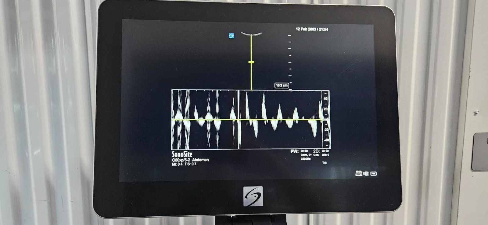SonoSite X-Porte Ultrasound