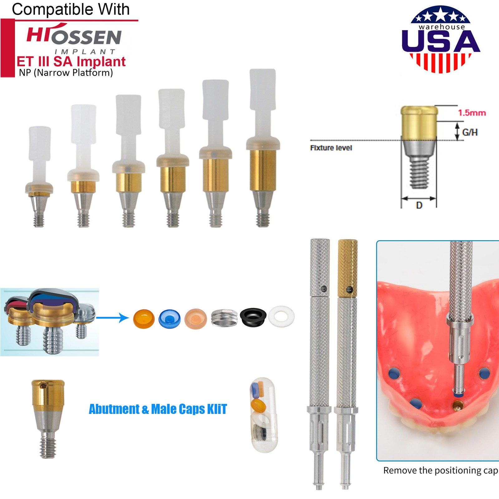 US Dental Locator Overdenture Abutment & Accessories Compatible Multiple Implant