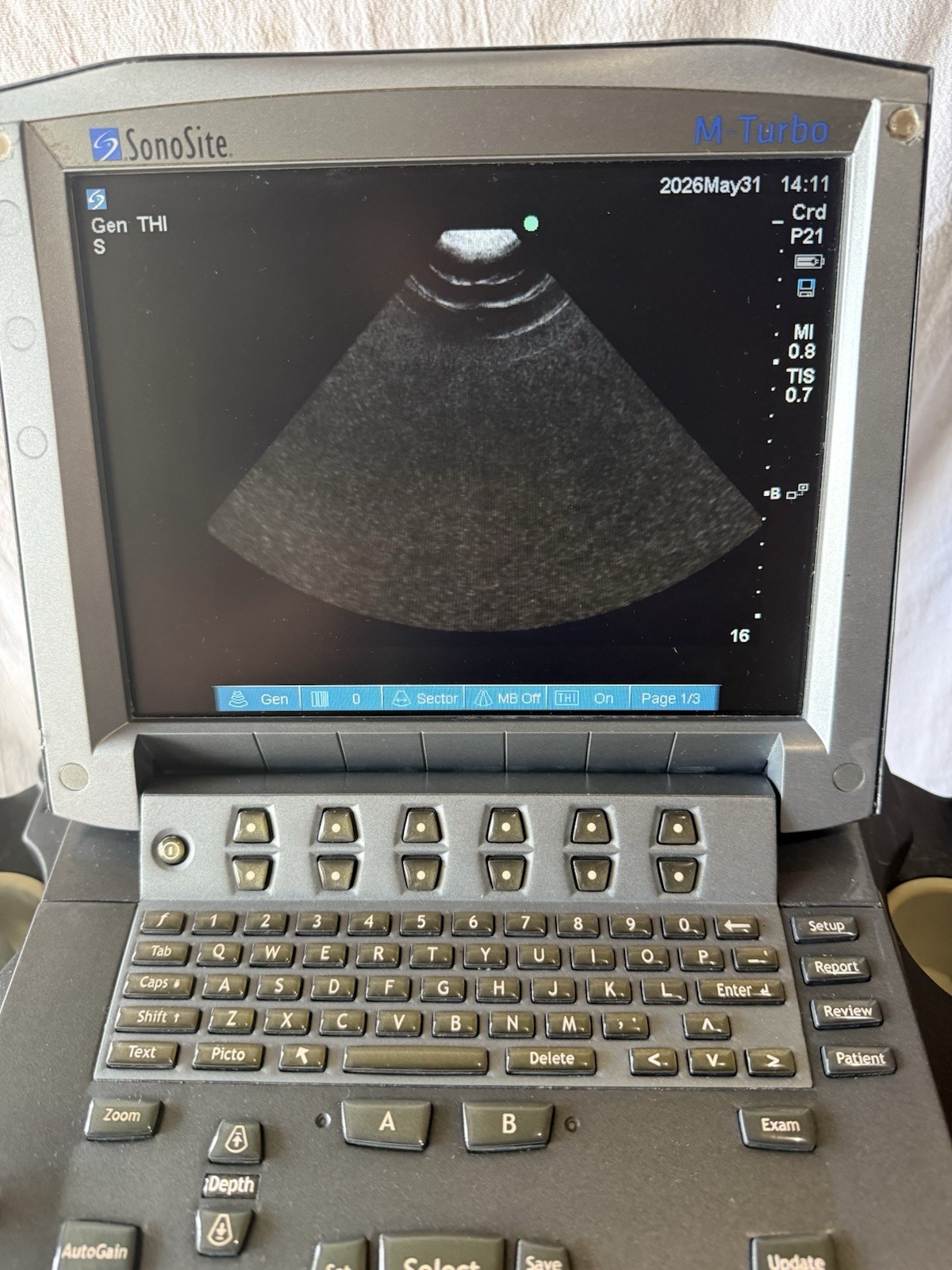 SonoSite M-Turbo Ultrasound System (2014) With 2 Transducer Probe & Rolling Car