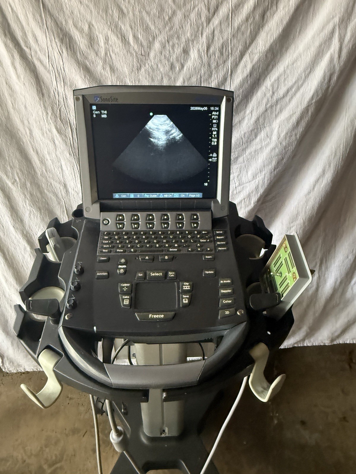 SonoSite M-turbo Portable Vet Ultrasound w/ C11x & P21x Transducer Probe