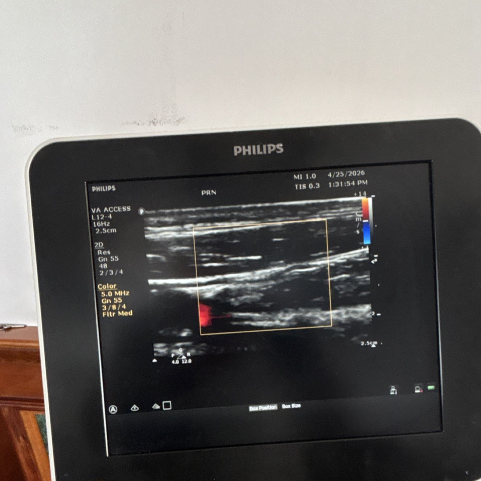 Philips Sparq Cart Mounted Ultrasound Machine Color Doppler with 3 probes