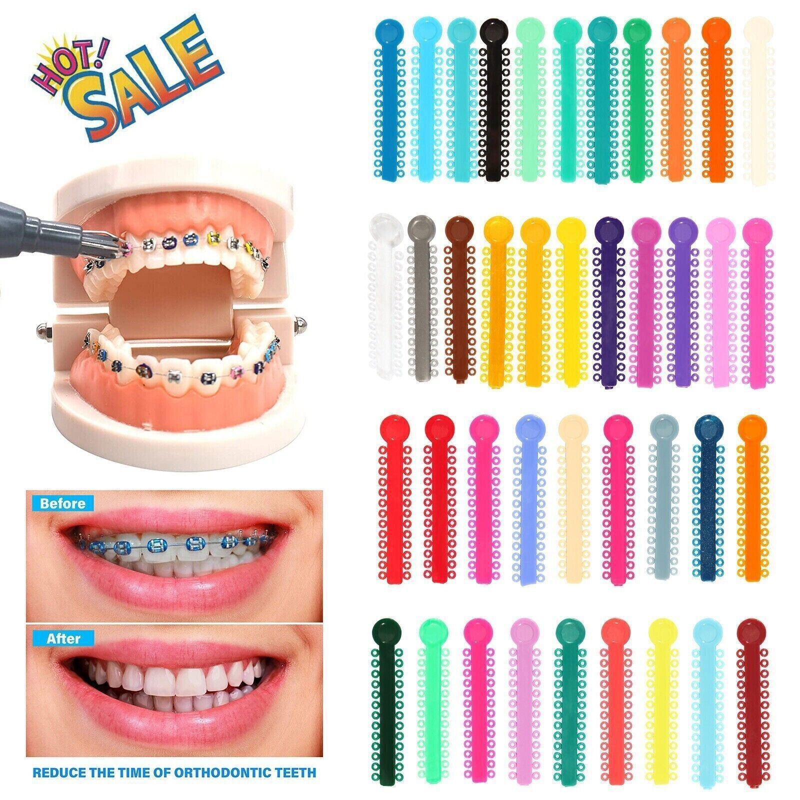 1040 Pcs Dental Orthodontic Ligature Ties Elastic Rubber Band Braces Mixed Color