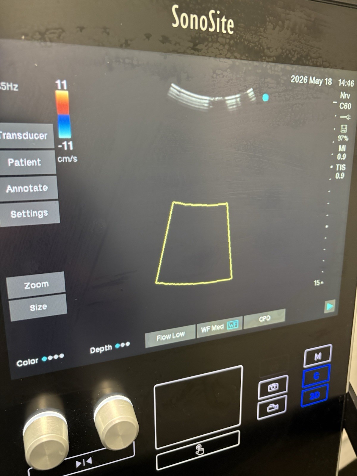 Sonosite SII Total Ultrasound System Ref P20883-12 With Three Probes (PLS READ)