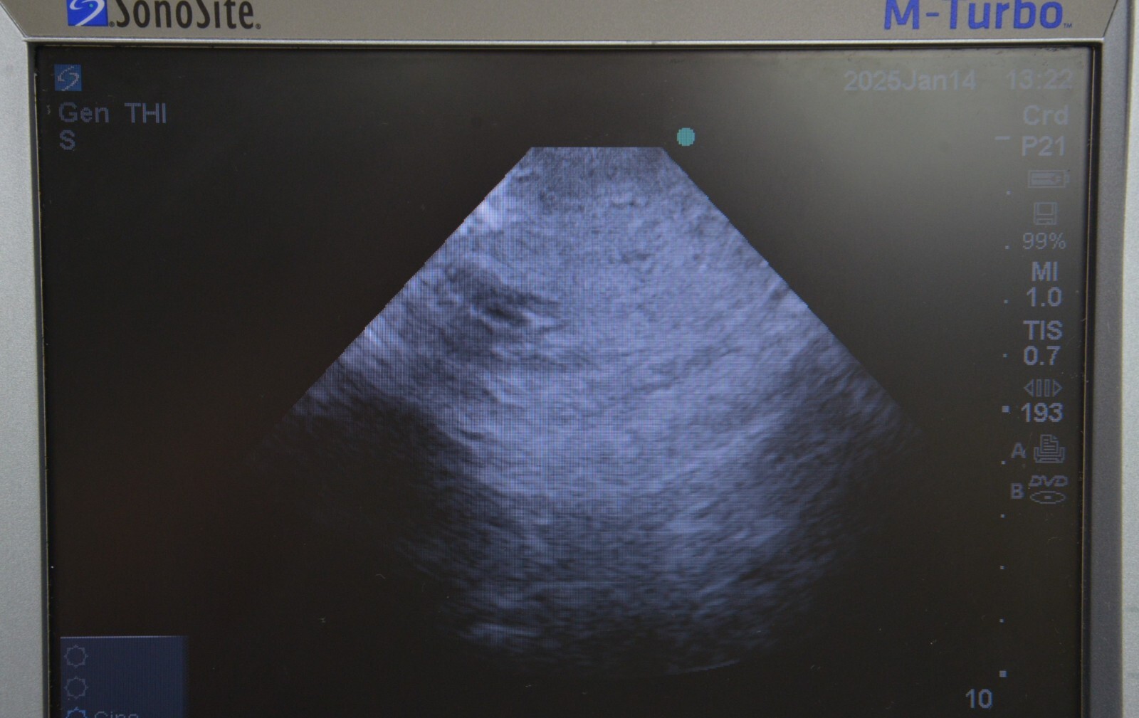 FujiFilm Sonosite P21x/5-1 MHz P07698-21