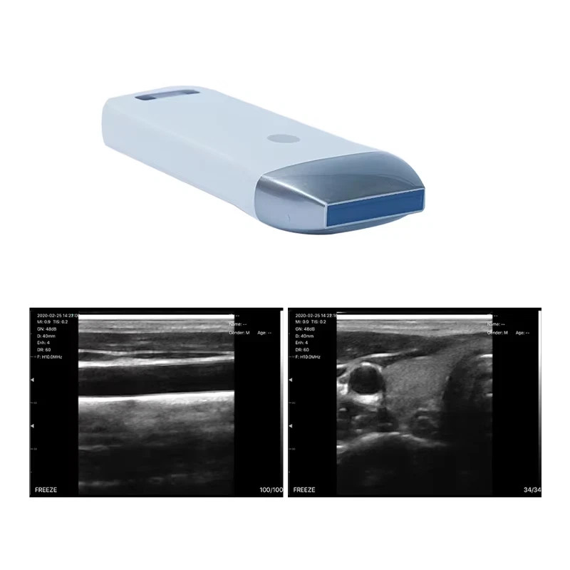 Wireless Ultrasound Probe Scanner Portable Machine Support iOS Android Windows