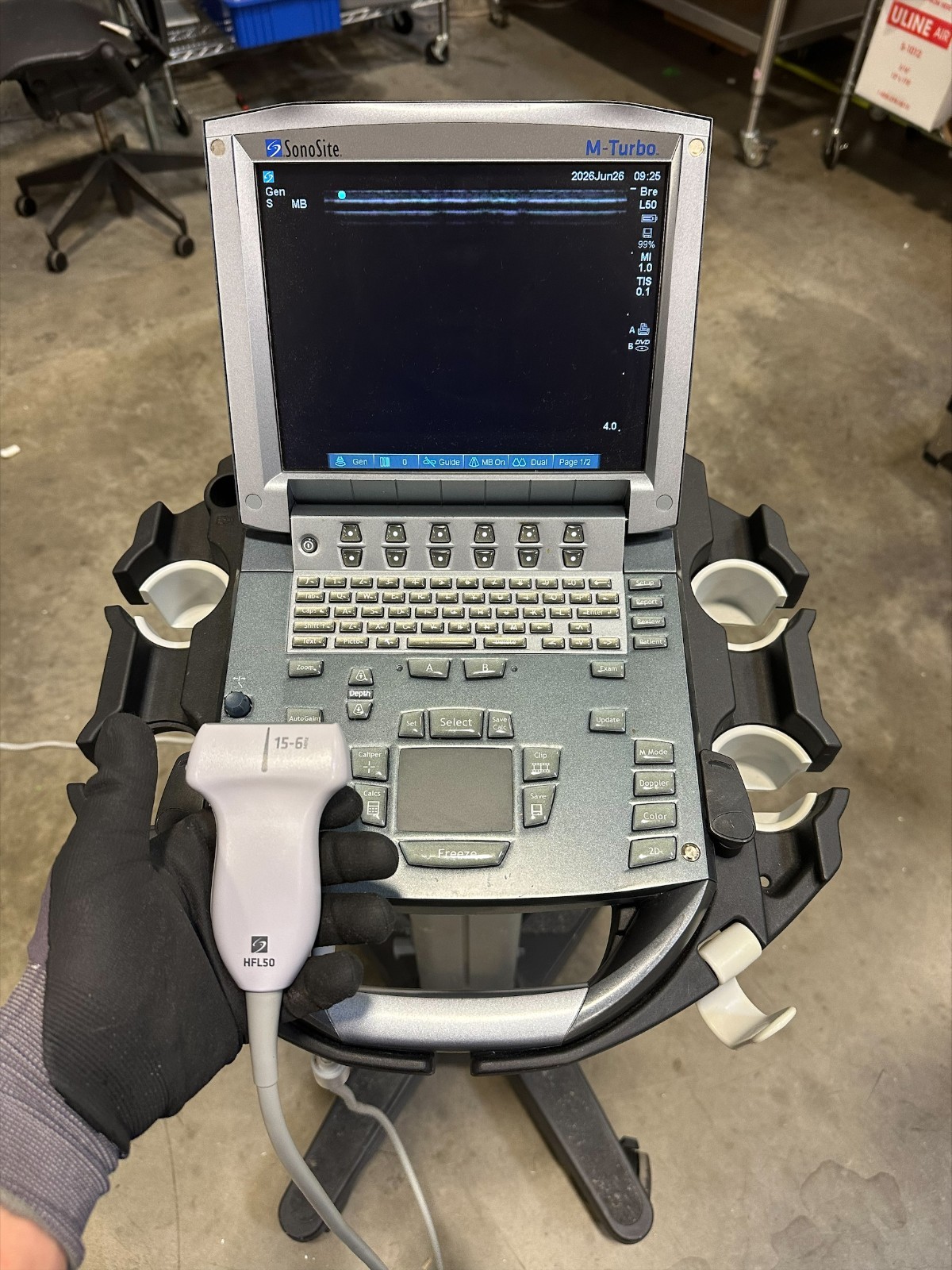 Sonosite M-Turbo Ultrasound With 15-6 Transducer