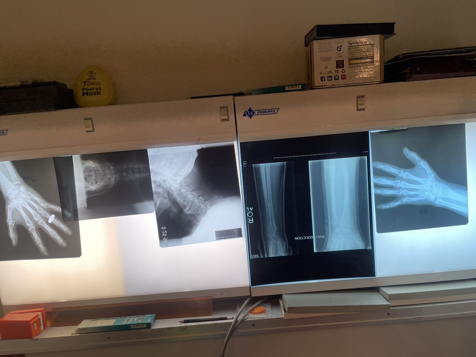 SCRAP X-RAY FILM – 1LB (Silver Recovery/Teaching/crafts)