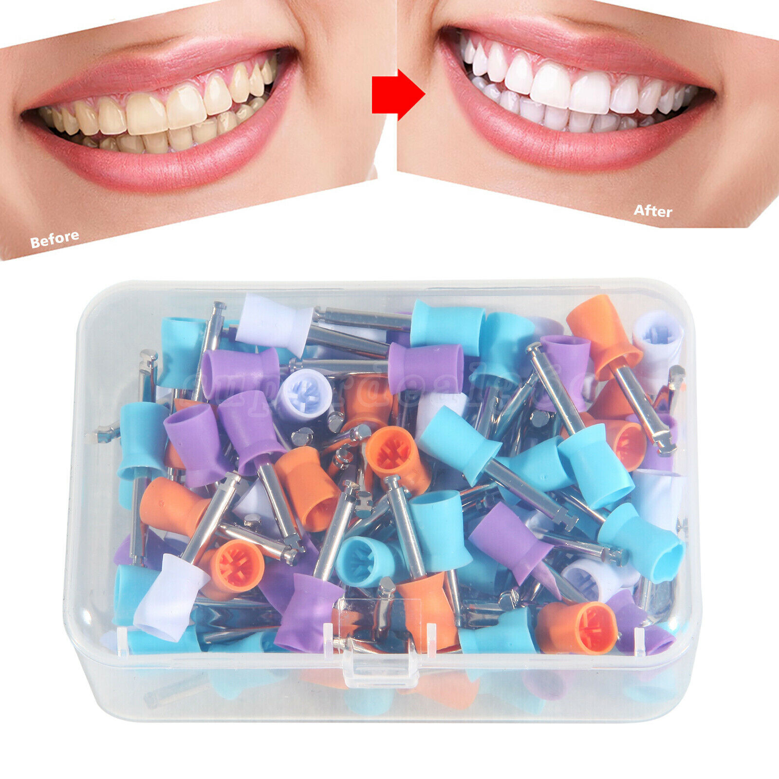 100*Dental Rubber Prophy Tooth Polish Polishing Cups Latch type brush Mixed OR