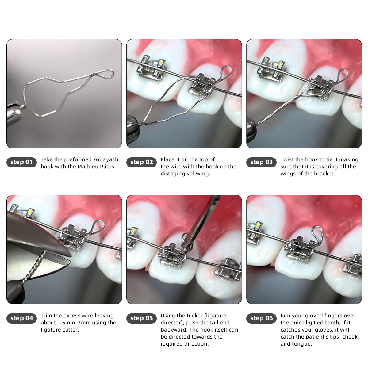 Dental Orthodontic Wire Preformed Kobayashi Ligature Wires Ties Long Short Twist