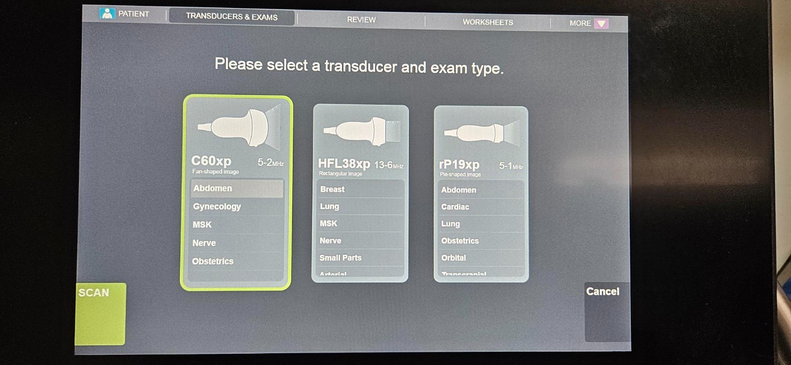 SonoSite X-Porte Ultrasound