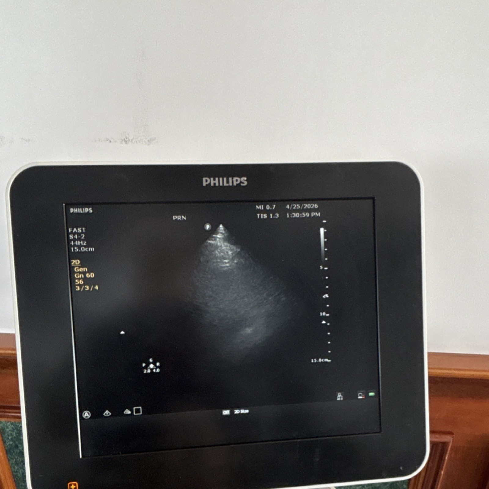 Philips Sparq Cart Mounted Ultrasound Machine Color Doppler with 3 probes