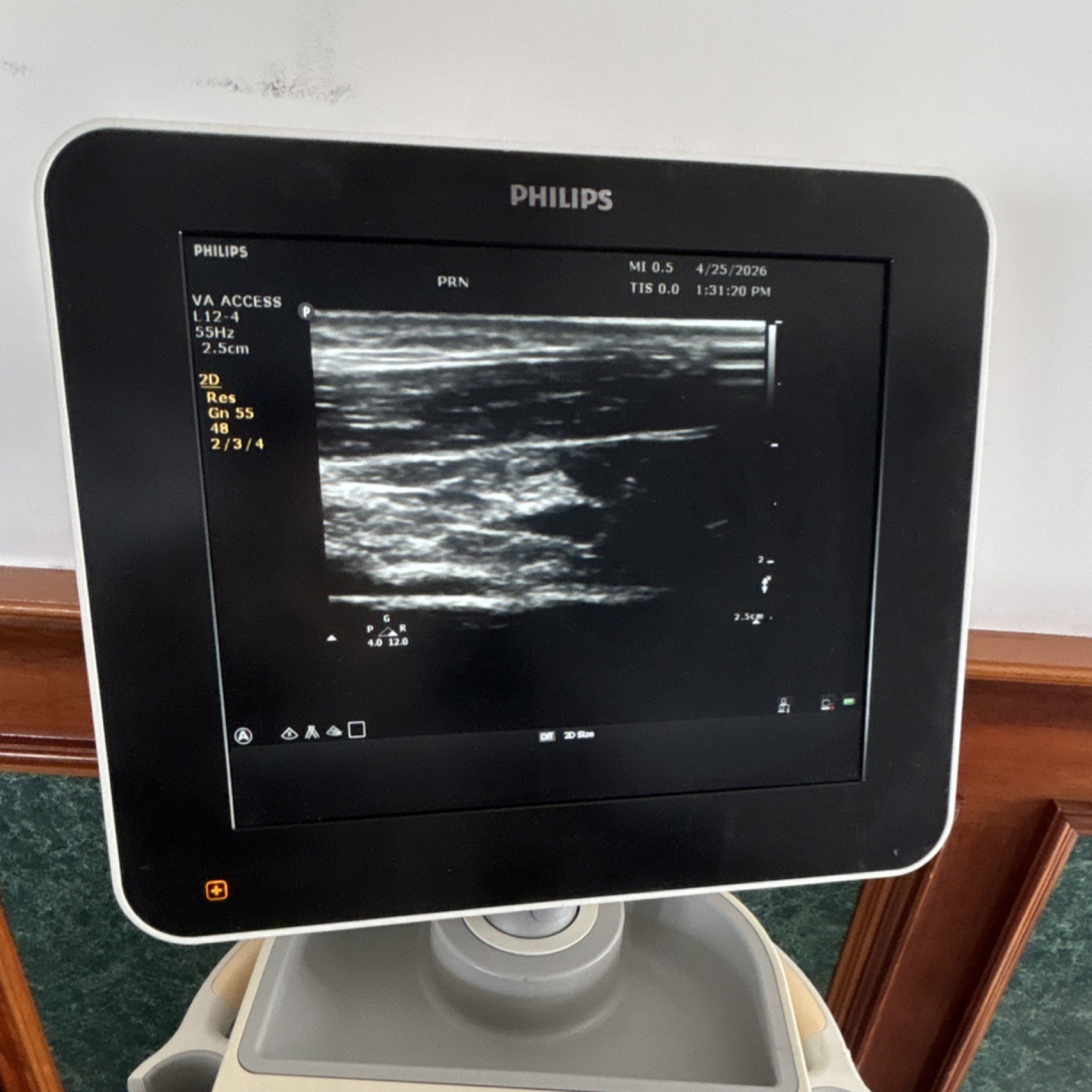 Philips Sparq Cart Mounted Ultrasound Machine Color Doppler with 3 probes