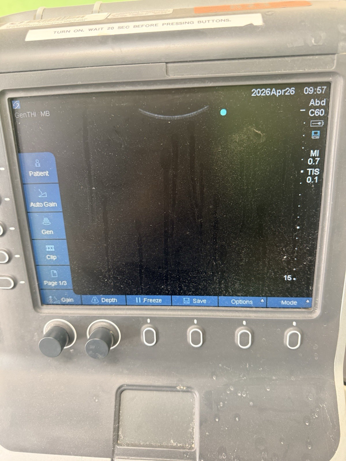 SonoSite M-Turbo Ultrasound Machine Cart System + Probes Tested Working Portable