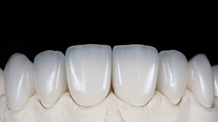 C14 Glass Ceramic Blocks HT LT Lithium Disilicate CAD/CAM Cerec Block 5Pcs/Box