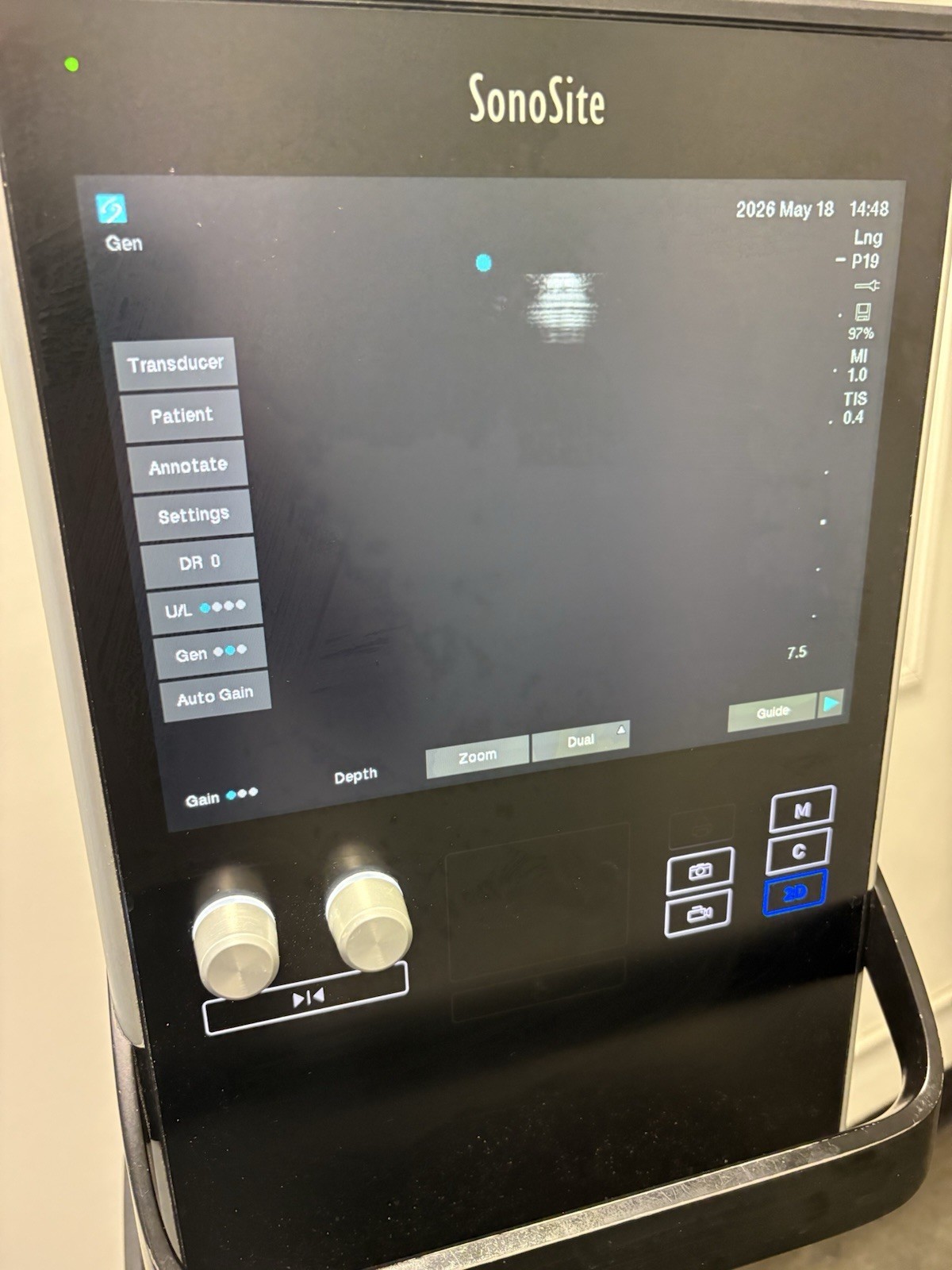 Sonosite SII Total Ultrasound System Ref P20883-12 With Three Probes (PLS READ)