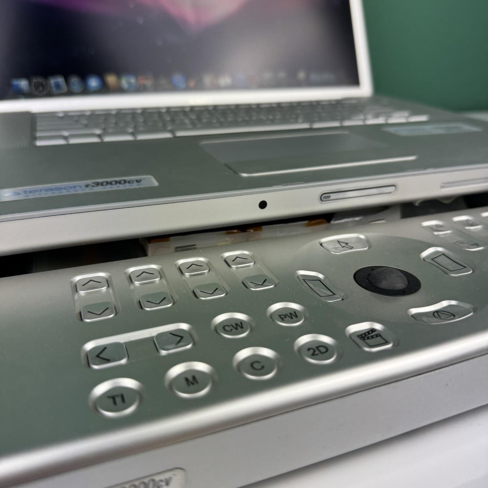 Terason T3000CV Ultrasound Machine / Ultrasound Device / MacBook Pro Base
