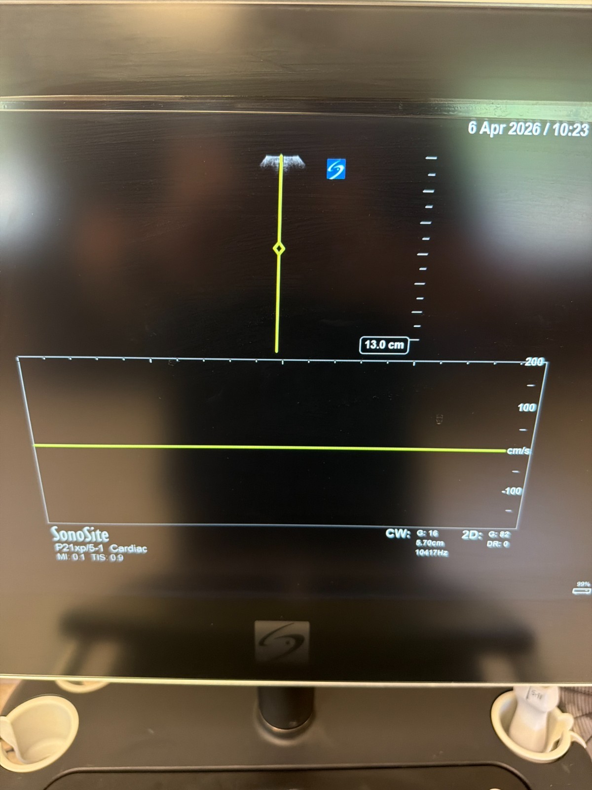 Sonosite P21xp (P14563-20) Ultrasound Transducer / Probe for X-Porte