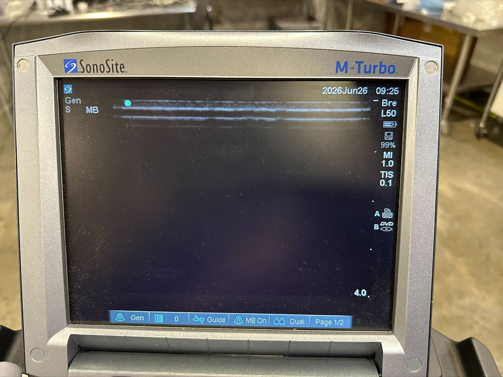 Sonosite M-Turbo Ultrasound With 15-6 Transducer
