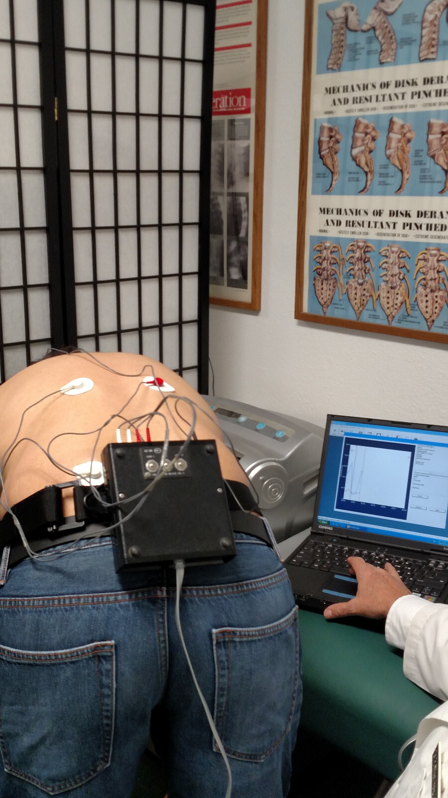 Myovision 8000 Static w/Dynamic sEMG wValidated Laptop Chiropractic Chiropractor
