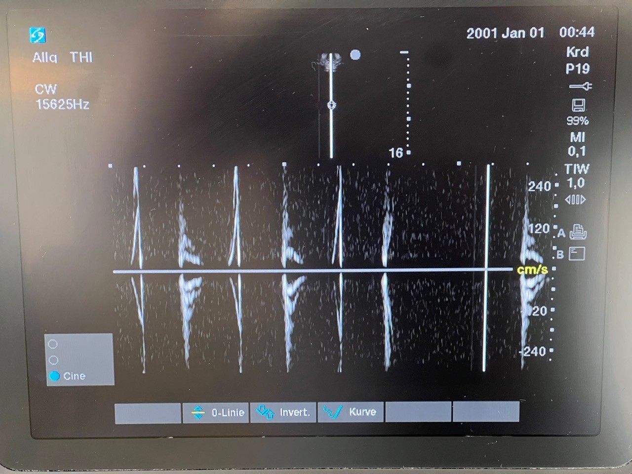 Ultrasound SonoSite Edge II 2017/09 + rP19x, rC60xi, HFL 38xi Transducer(#2335)