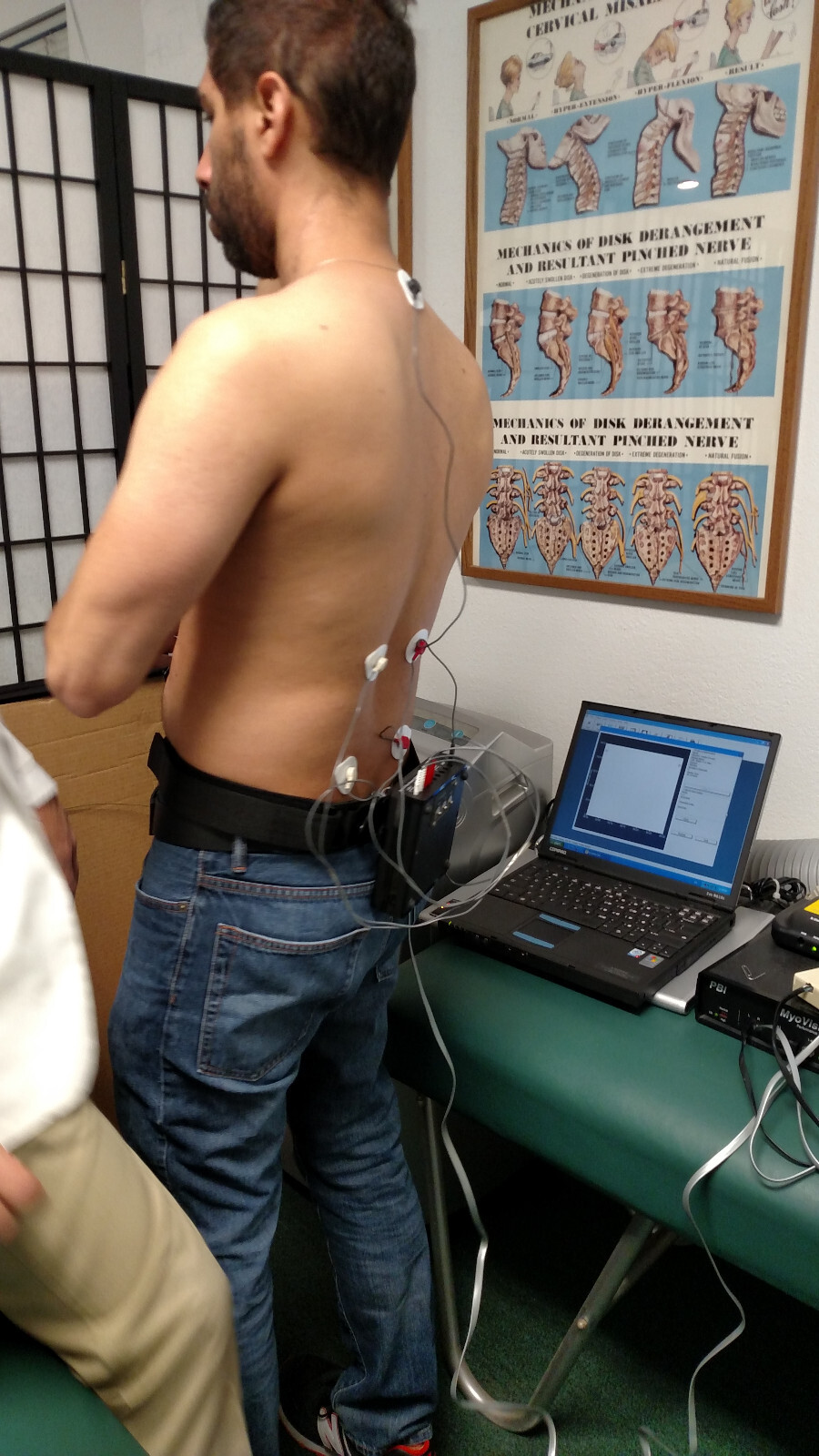 Myovision 8000 Static w/Dynamic sEMG wValidated Laptop Chiropractic Chiropractor