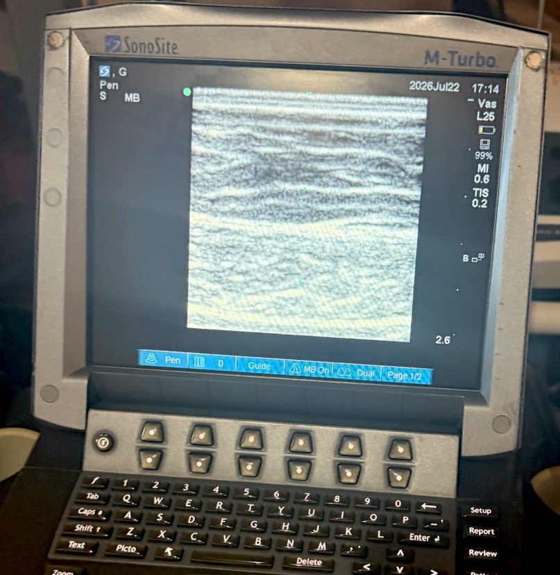 SonoSite M-Turbo Ultrasound System (2014) With 2 Transducer Probe & Rolling Car