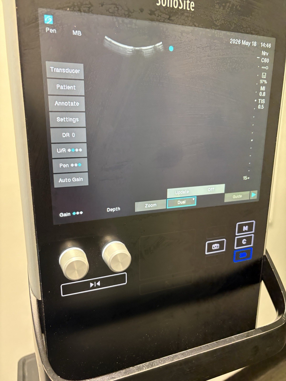 Sonosite SII Total Ultrasound System Ref P20883-12 With Three Probes (PLS READ)