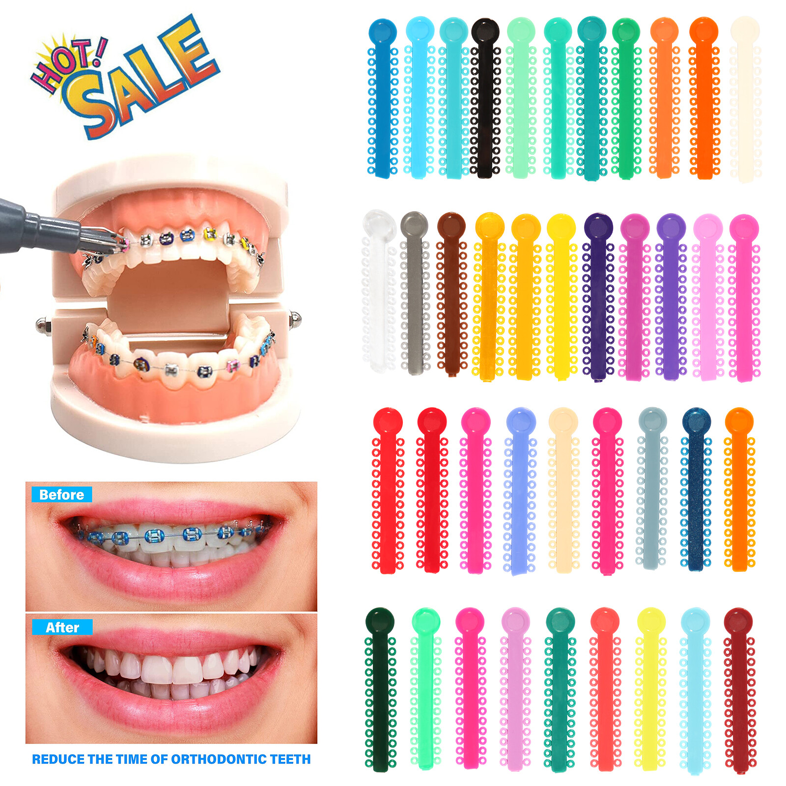 Dental Orthodontic Braces Ligature Ties Elastic Rubber Bands 43 Color 1040Pcs