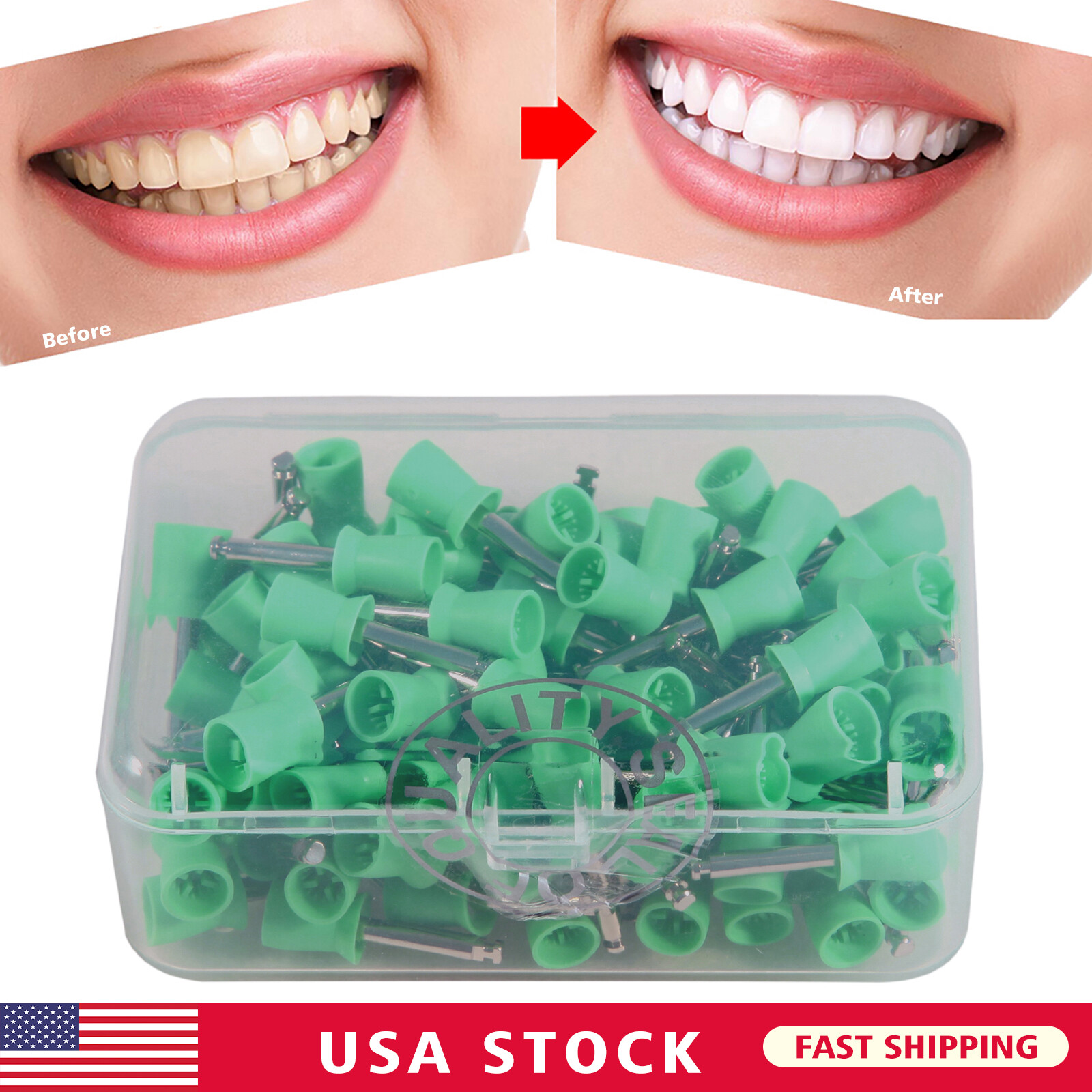 100-1000pcs Dental Rubber Polishing Prophylaxis Cups Brushes Prophy Polisher CUP