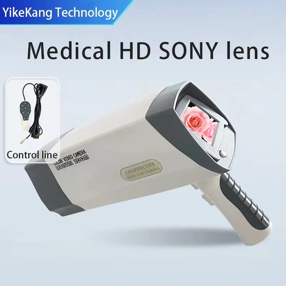 Electronic Digital Colposcope Video HD For Gynecology Colposcopy Imaging System