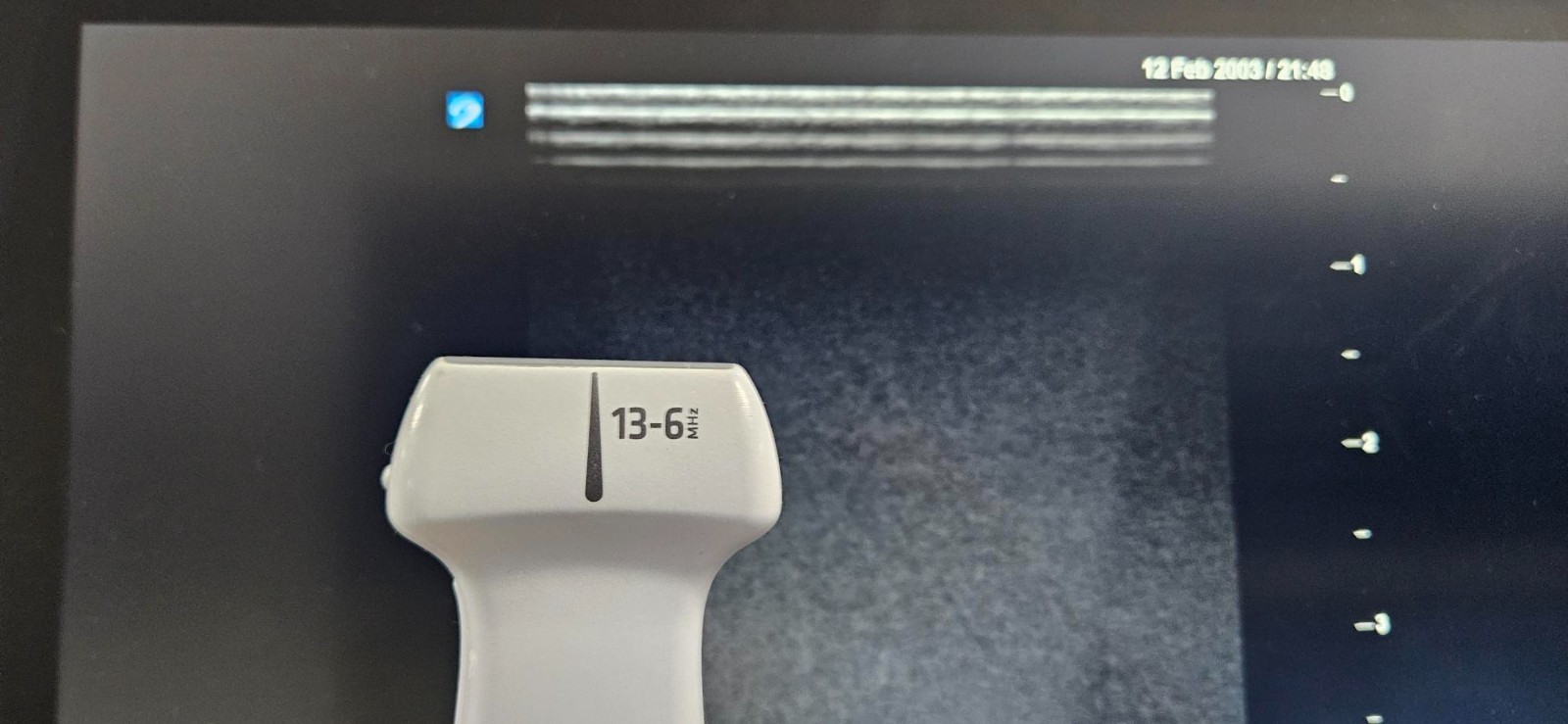 SonoSite X-Porte Ultrasound
