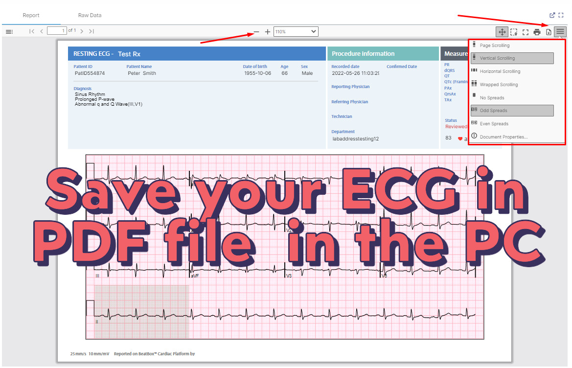 Welch Allyn Diagnostic Cardiology Suite PC ECG with Laptop/ Cadio Connex ECG