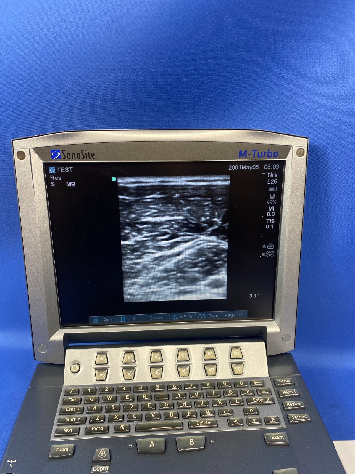 Fujifilm Sonosite L25x/13-6 MHz Ultrasound Transducer M-Turbo Edge Edge II S II